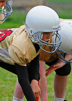 mouthguards